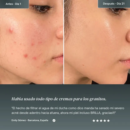 OASIS Cabezal con Sistema de Filtración 15 Etapas + Vitamina C